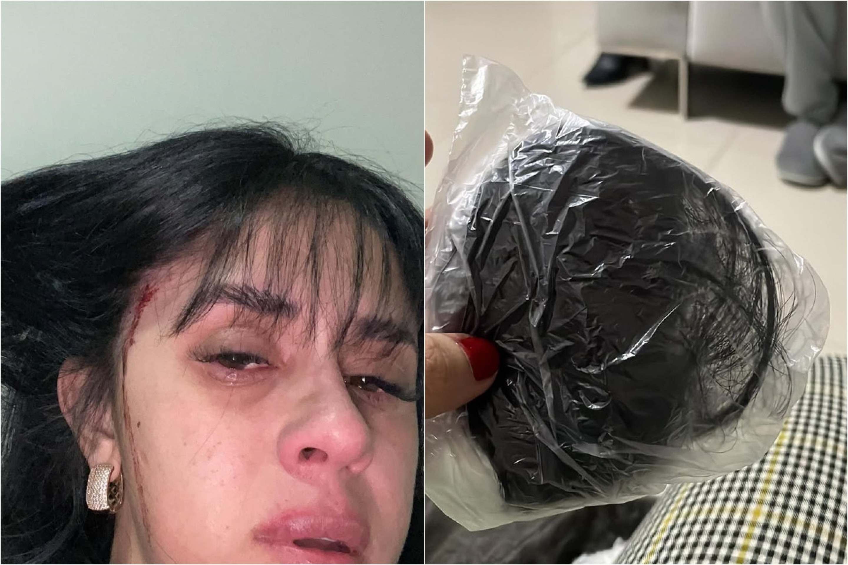 Cantora sertaneja é agredida e tem cabelo cortado logo após sofrer ameaças